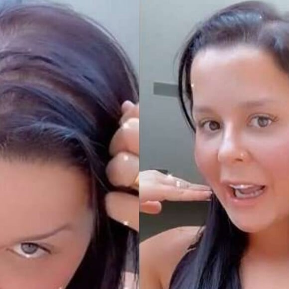 Cantora Maraisa revelou que assim como Maiara ela tem alopecia.