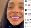 Brunna Gonçalves colocou lentes nos dentes e mostrou o resultado no seu Instagram