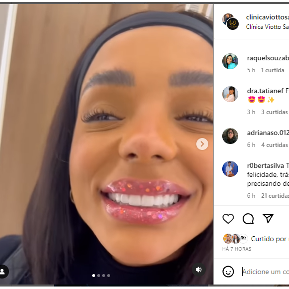 Brunna Gonçalves colocou lentes nos dentes e mostrou o resultado no seu Instagram