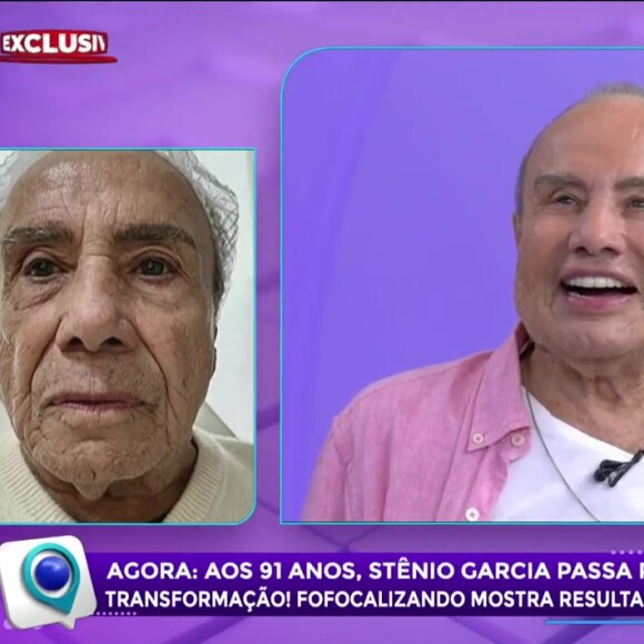 Stênio Garcia chamou a atenção recentemente ao fazer harmonização facial aos 91 anos