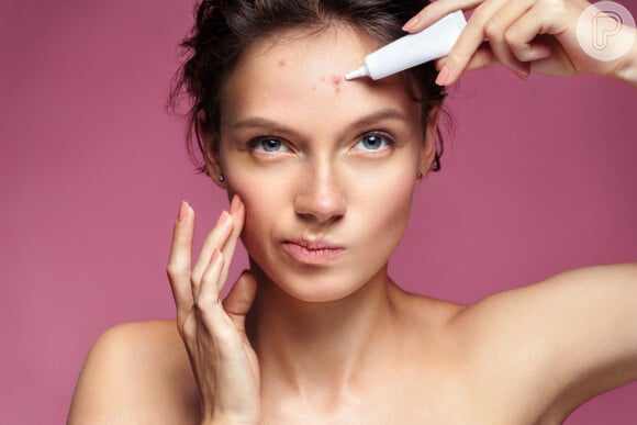 Pele oleosa e com acne no verão: o que fazer? Médica revela cuidados com maquiagem, que deve ter textura mais leve