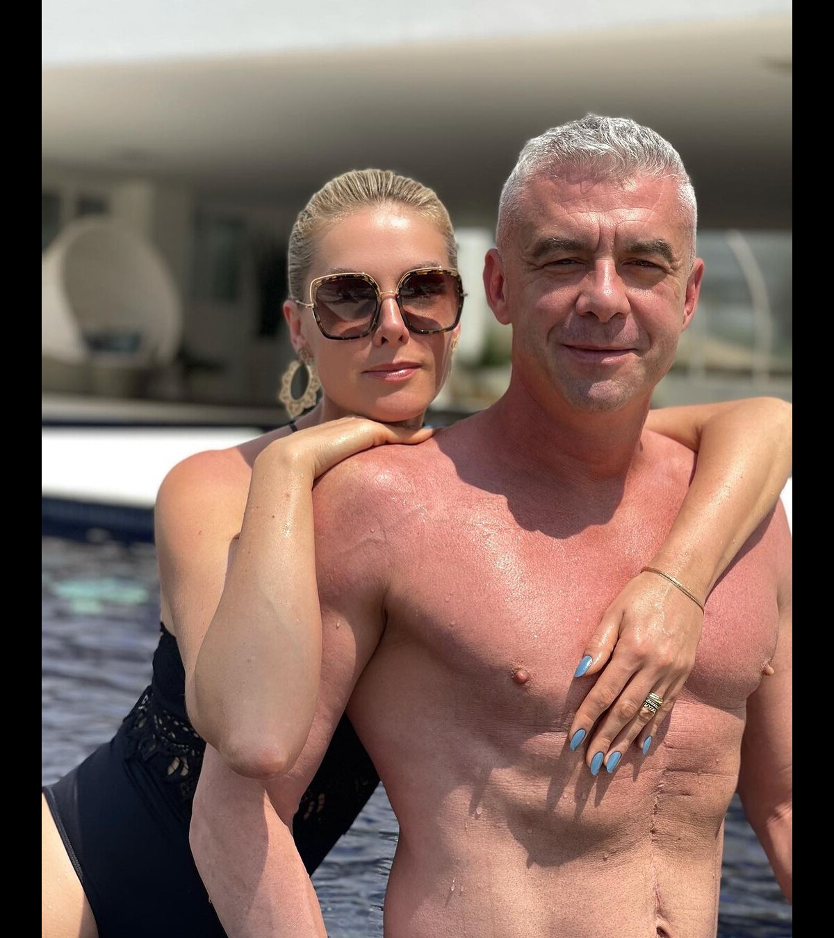 Foto Marido De Ana Hickmann Alexandre Correa Negou Que Tenha Agredido A Mulher E Chamou O