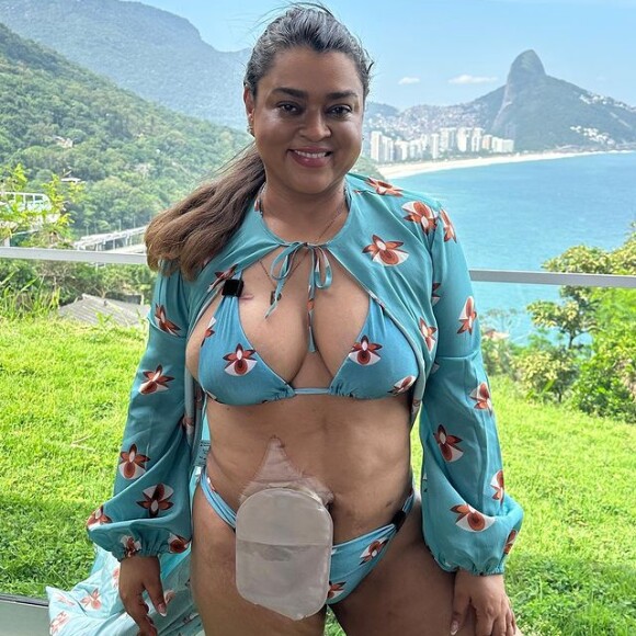 A bolsa de ileostomia ajudou Preta Gil a se curar de um cancer no intestino