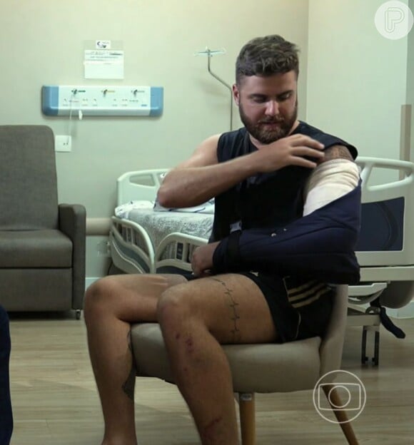 Zé Neto quebrou 3 costelas, levou pontos no braço e sofreu uma contusão pulmonar