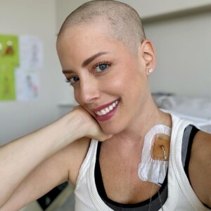 Fabiana Justus decidiu raspar a cabeça logo que seus cabelos começaram a cair