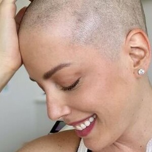 Careca, Fabiana Justus revelou como foi a reação das filhas ao vê-la sem cabelo