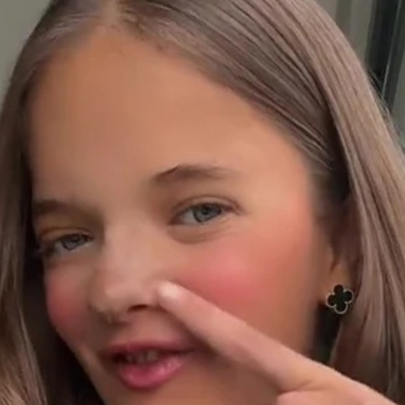1 mês após rinoplastia, Rafaella Justus volta a exibir resultado de cirurgia em evento da cunhada