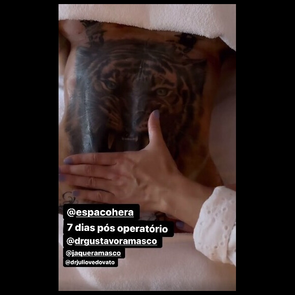 Andressa Urach adiantou o resultado da operação durante uma sessão de drenagem linfática nesta quinta-feira (21)