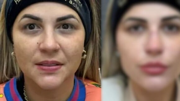 Deolane Bezerra gasta fortuna em 6 procedimentos no rosto de uma só vez e impressiona com antes e depois. Veja foto!