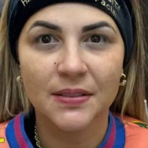 Deolane gasta fortuna em procedimentos estétios e muda o rosto completamente