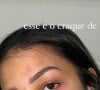 Ex-namorada de Kauê Rodrigues, Isabella Ribeiro mostrou rosto machucado, segundo ela, de agressões sofridas por parte do jogador: 'Quem acredita em mim, acredita. Quem não acredita, a Justiça vai provar'