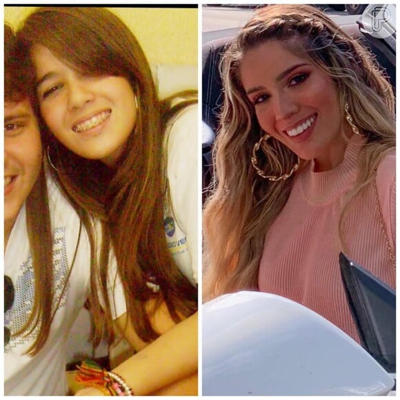 Antes e depois de Karoline Lima: há alguns anos, a modelo já impressionava com uma mudança significativa