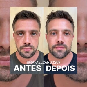 O antes e depois de Rafael Cardoso