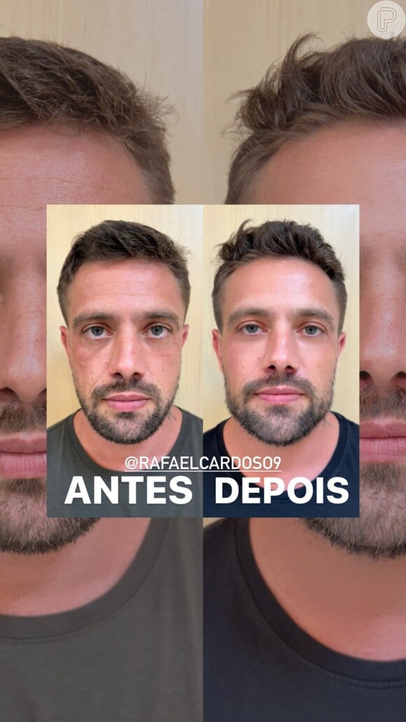 O antes e depois de Rafael Cardoso