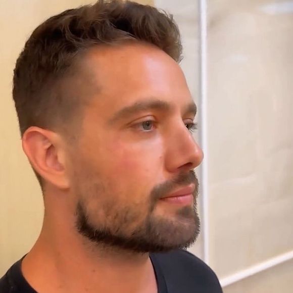 Rafael Cardoso assumiu que tinha receio de fazer harmonização facial