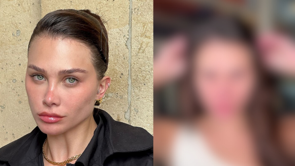 Flavia Pavanelli expõe rosto com espinhas em vídeo sem maquiagem e manda recado: 'Não se compare'