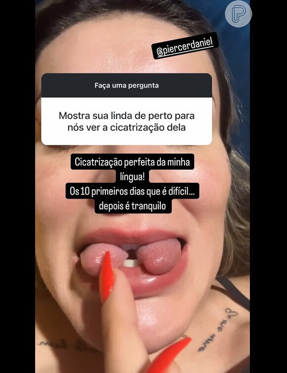 Andressa Urach mostrou resultado da bifurcação da língua, mais de um mês após o procedimento