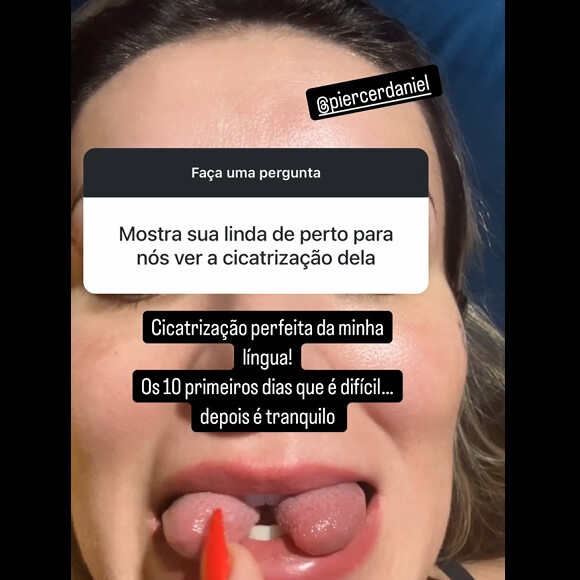 Andressa Urach mostrou resultado da bifurcação da língua, mais de um mês após o procedimento