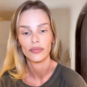 No próprio vídeo, Yasmin Brunet explicou que um dos lugares que mais mostram seu emagrecimento é no rosto e, por isso, tinham perdido volume