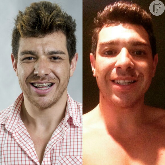 Campeão do 'BBB15', Cézar Lima mostra novo visual após tirar aparelho dos dentes