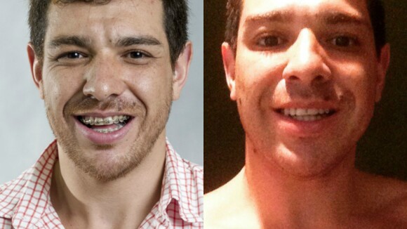 Campeão do 'BBB15', Cézar mostra novo visual sem barba e aparelho nos dentes