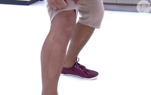 André Marques mostrou também o resultado da depilação na perna direita, no 'Mais Você'