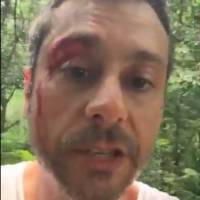Alexandre Nero exibe 'ferida' em cena de 'A Regra do Jogo': 'Romero sangrando'