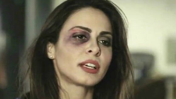 Maquiador sobre 'ferimentos' de Alinne Rosa para campanha: 'Fiz em 30 minutos'
