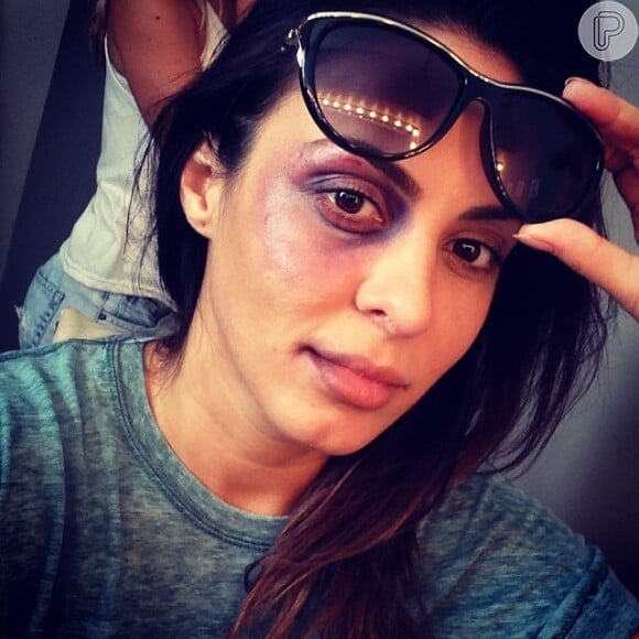 Alinne Rosa postou uma foto sua maquiada no Instagram. 'Felizmente isso no meu rosto é maquiagem, mas, a violência contra a mulher é uma infeliz realidade. Não se intimide. Não se envergonhe. Denuncie! Não deixe a violência ficar anônima!'