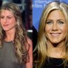 Jennifer Aniston já afirmou, há alguns anos, ter feito uma operação no nariz, mas para corrigir um desvio de septo nasal, de acordo com ela