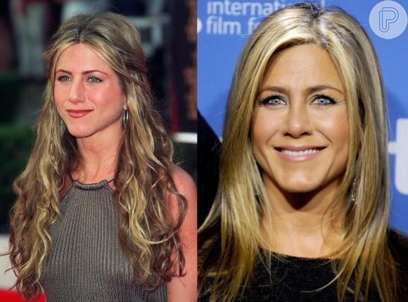 Jennifer Aniston já afirmou, há alguns anos, ter feito uma operação no nariz, mas para corrigir um desvio de septo nasal, de acordo com ela