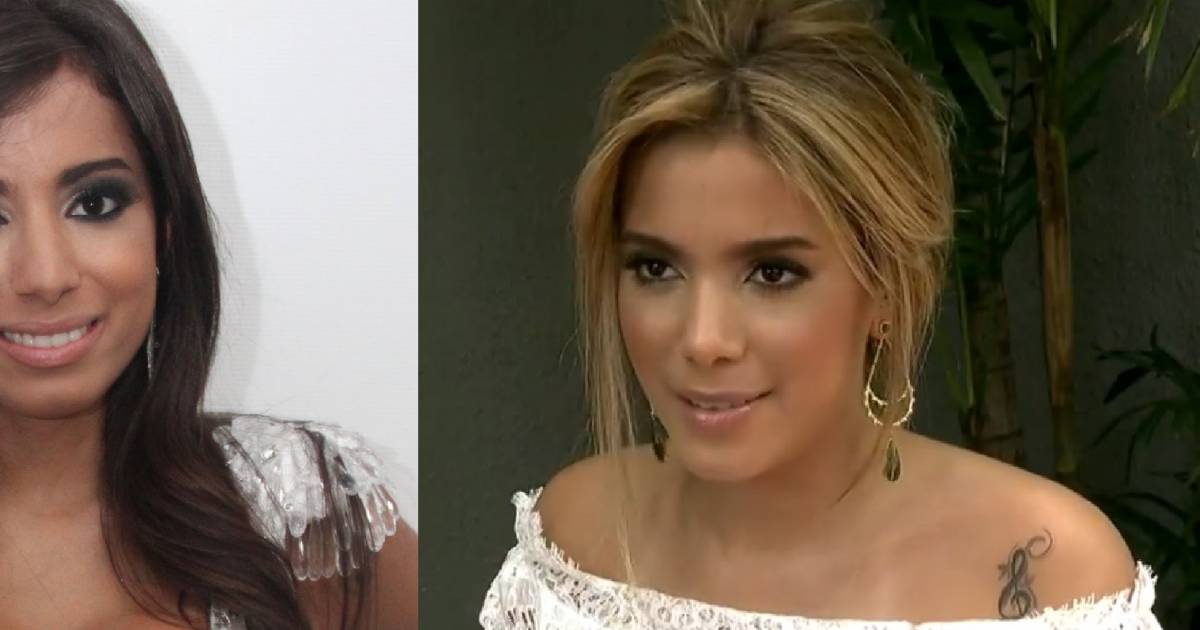Antes e depois: veja famosas que, assim como Anitta, fizeram plástica no na...