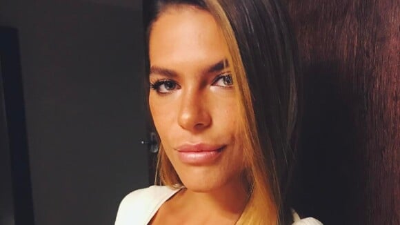 Modelo Mariana Goldfarb afirma detestar mancha no rosto: 'Parece um bigodinho'