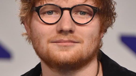 Ed Sheeran tem braço imobilizado após ser atropelado: 'Talvez afete os shows'