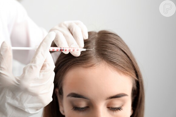 Mesoterapia pode resolver uma queda de cabelo temporária, já que injeta substâncias que estimulam o crescimento dos fios direto no couro cabeludo