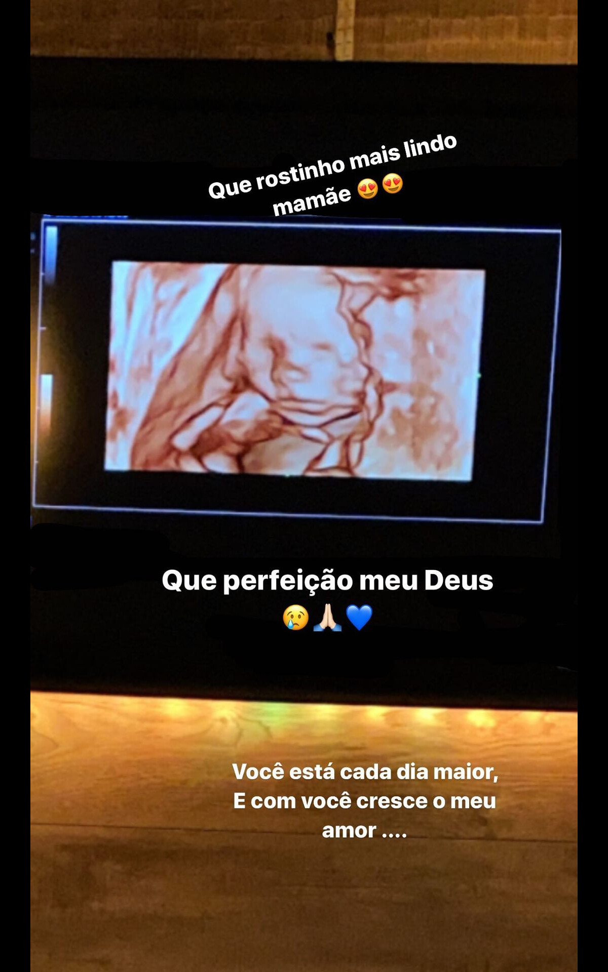 Foto Biah Rodrigues Mostrou O Ultrassom No Qual Rostinho De Theo Seu Filho Com Sorocaba 