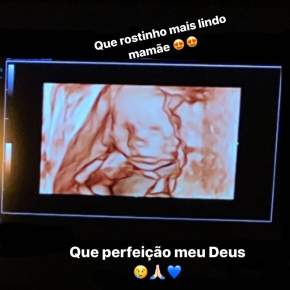 Biah Rodrigues mostrou o ultrassom no qual rostinho de Theo, seu filho com Sorocaba, aparecia