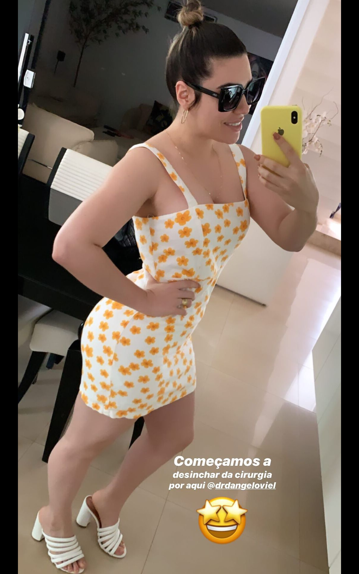 Foto Naiara Azevedo Mostrou Corpo Após Lipo No Abdômen Braços Coxas E Costas Purepeople 7487