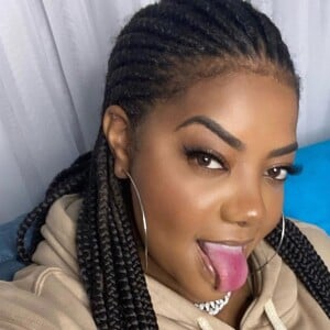 Ludmilla promete exibir corpo após pós-operatório: 'Estou um pouco inchada ainda'