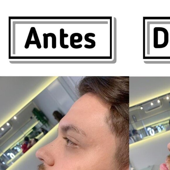 Joelma mostrou resultado da harmonização facial do filho de 24 anos