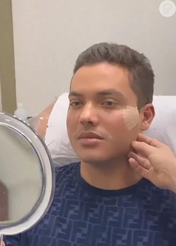 Wesley Safadão faz harmonização facial para ficar com 'rostinho de bebê'