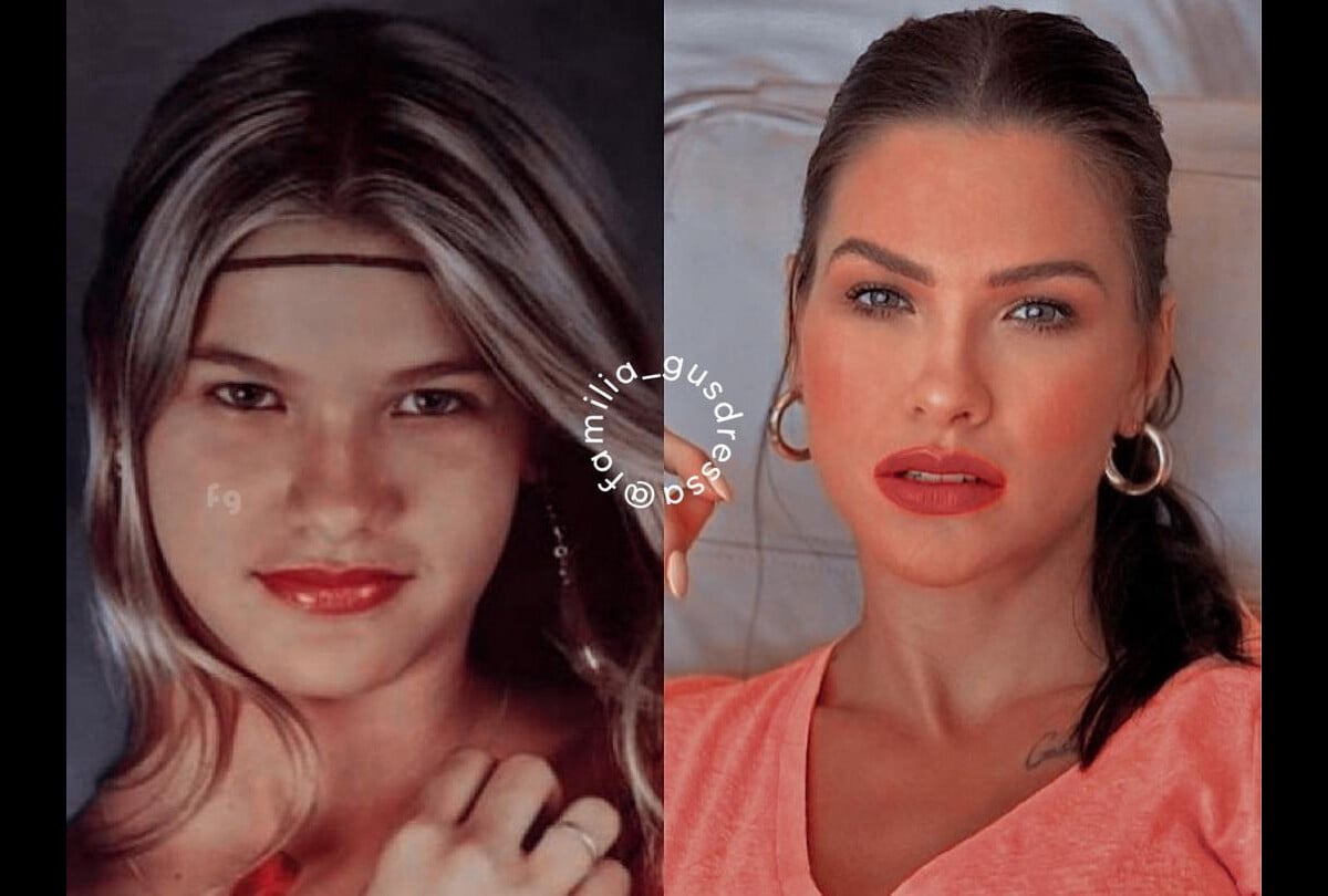 Foto Antes E Depois De Andressa Suita Veja Como Era A Famosa Antes Da Fama Purepeople