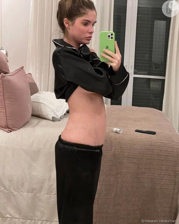 Bárbara Evans vem mostrando detalhes das mudanças de seu corpo, que passa pelo tratamento para engravidar, no Instagram