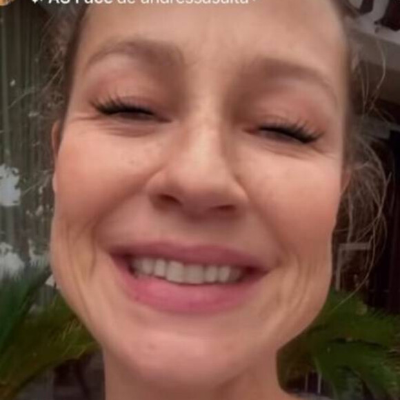 Luana Piovani passou por novo procedimento estético no rosto