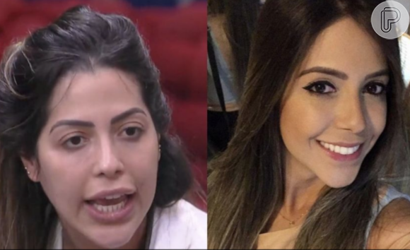 Veja o antes e depois da harmonização facial de Laís Caldas