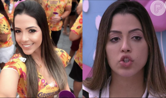 Laís Caldas surpreendeu os internautas após fotos do seu antes e depois da harmonização facial