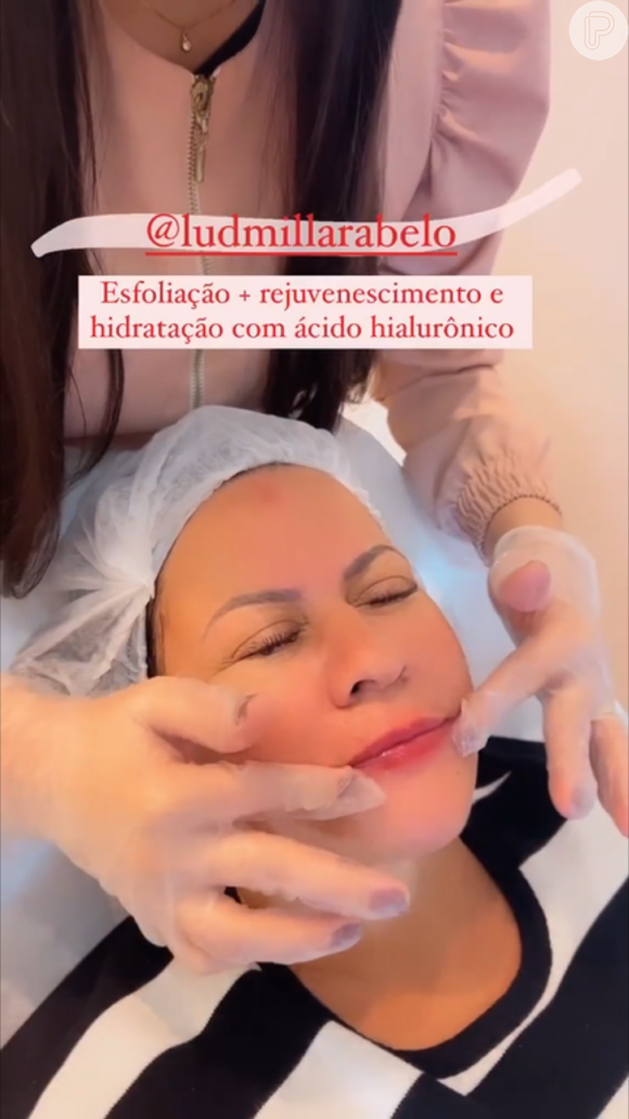 Ruth Moreira foi submetida a um procedimento chamado de Spa dos Lábios, que consiste em um processo de hidratação da região com ácido hialurônico