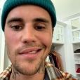  Por causa da síndrome, Justin Bieber não consegue mover metade de seu rosto 