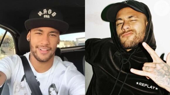 Tratamento na pele de Neymar já é feito há algum tempo