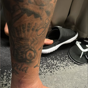 Pé inchado de Neymar choca internautas